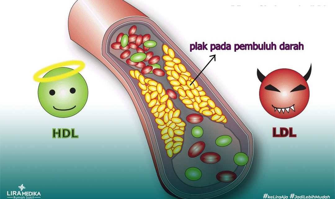 Mengenal Kolesterol: Jenis, Fungsi, Dan Dampaknya bagi Tubuh