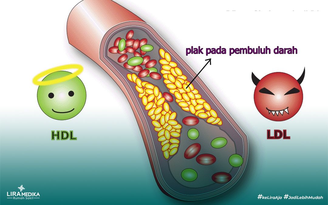 Mengenal Kolesterol: Jenis, Fungsi, Dan Dampaknya bagi Tubuh