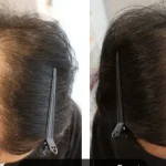 Merawat Kesehatan Rambut Tetap Kuat Dan Tidak Mudah Rontok