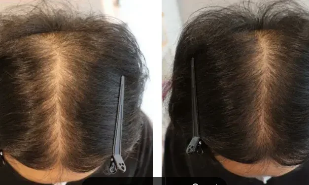Merawat Kesehatan Rambut Tetap Kuat Dan Tidak Mudah Rontok