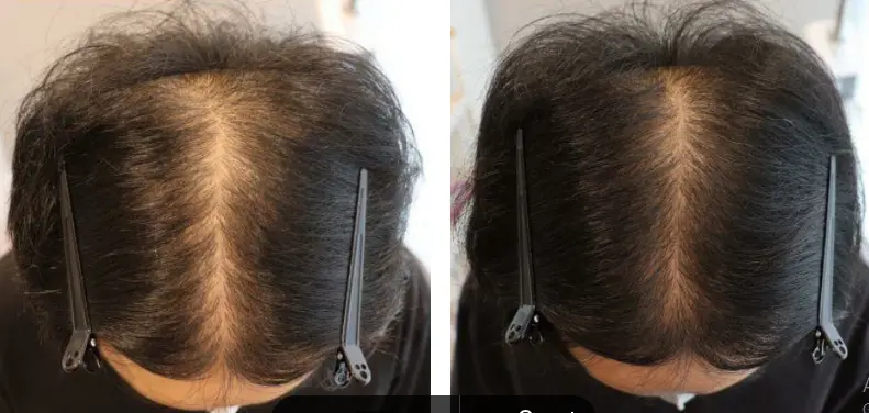 Merawat Kesehatan Rambut Tetap Kuat Dan Tidak Mudah Rontok