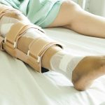 Operasi Tulang Kaki: Mengenal Prosedur, Dan Tahapan Pemulihan