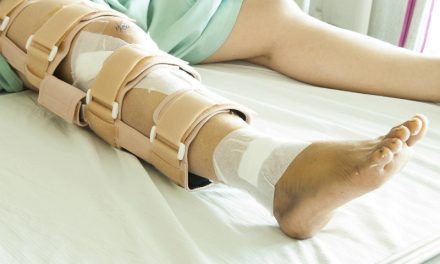 Operasi Tulang Kaki: Mengenal Prosedur, Dan Tahapan Pemulihan