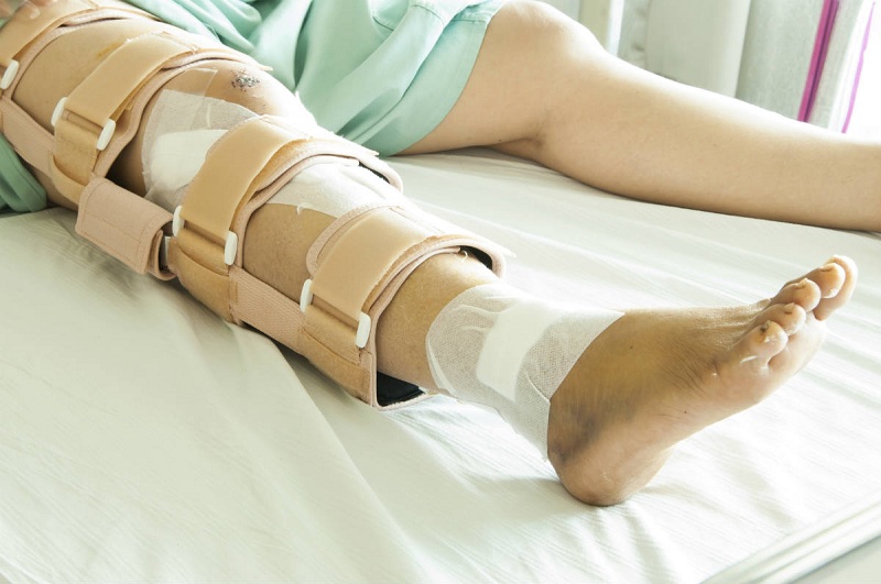 Operasi Tulang Kaki: Mengenal Prosedur, Dan Tahapan Pemulihan